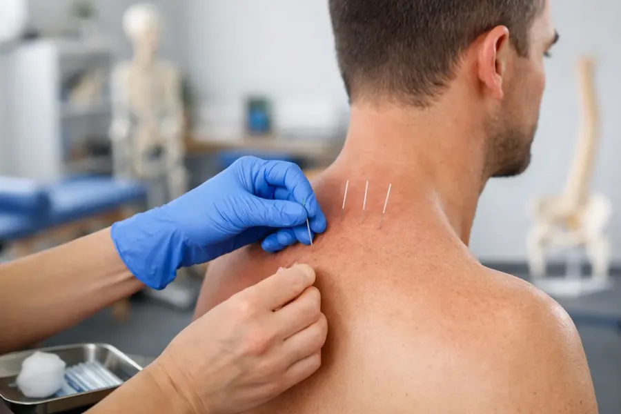 Dry Needling