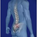 σπονδυλικη στηλη - μυοσκελετικου συστηματος - παθησεις - Ιερολαγονίτιδα Σπονδυλική Στήλη